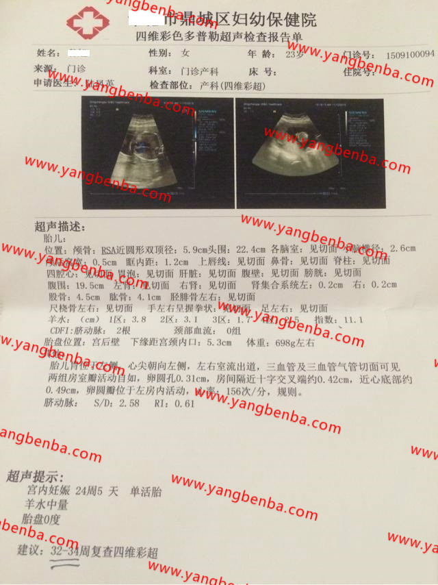 B超检查报告单样本